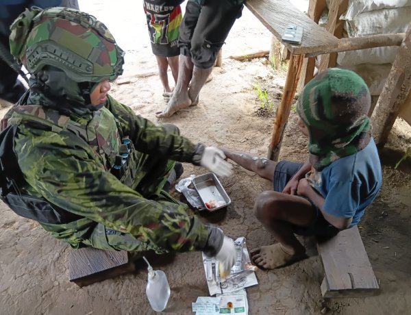 Satgas Yonif 742/SWY Obati Anak Papua yang Alami Infeksi Menahun di Andugume Lanny Jaya
